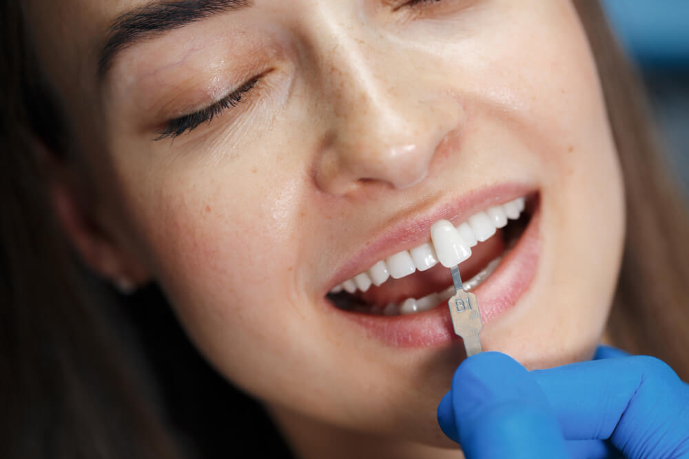 dentist-white-teeth (1)